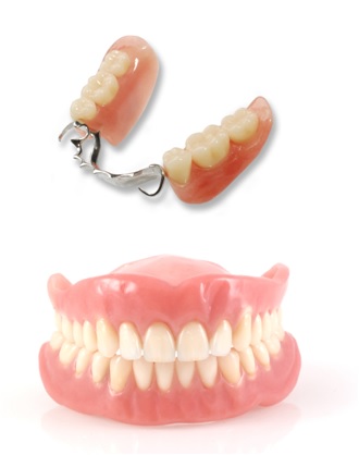 dental prosthesis