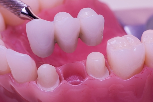 zubna-protrtika